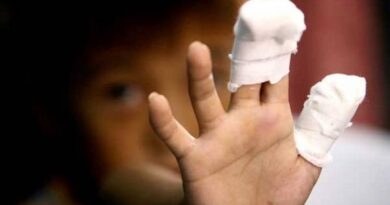 Počinje kampanja “Petarde nisu igračke”