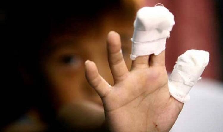 Počinje kampanja “Petarde nisu igračke”