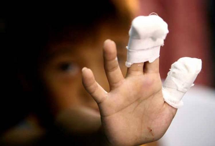 Počinje kampanja “Petarde nisu igračke”